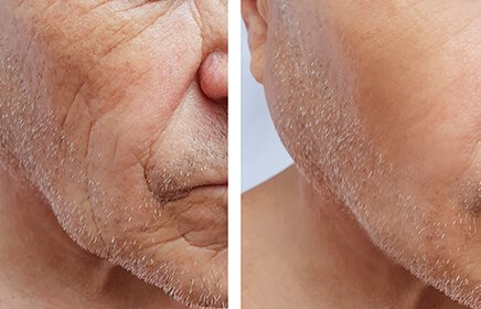 ANTİ AGİNG MAKYAJ NASIL YAPILIR 2 anti aging nedir 5